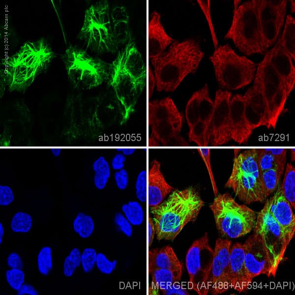 Alexa Fluor® 488 Anti-Cytokeratin 14 antibody [EP1612Y](AB192055)