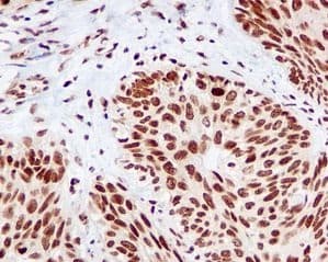 Rcc1 Antibody Epr5857 Bsa And Azide Free Ab226061  Immunohistochemistry Formalin Pfa Fixed Paraffin Embedded Sections Img132812