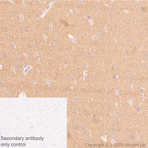 Anti-beta Synuclein antibody [EP1537Y] - BSA and Azide free(AB221908)