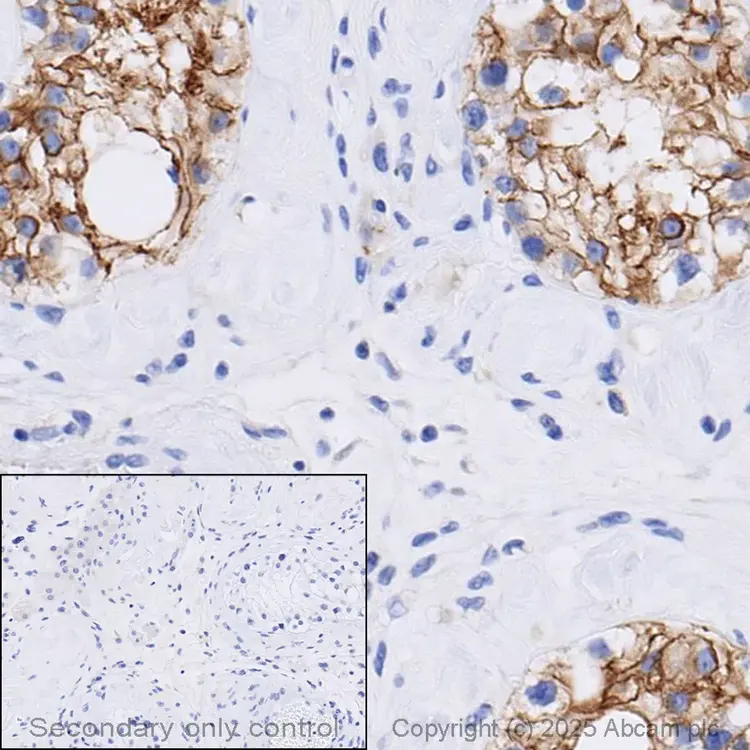 Anti-N Cadherin antibody - Intercellular Junction Marker(AB18203)