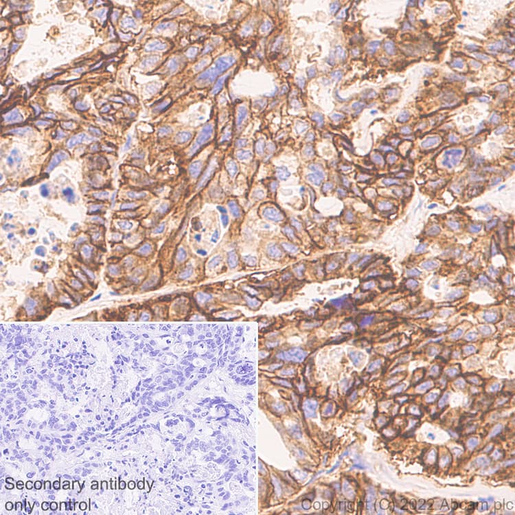 Cd47 Antibody Epr24922 5 Ab300435  Immunohistochemistry Formalin Pfa Fixed Paraffin Embedded Sections Img400681