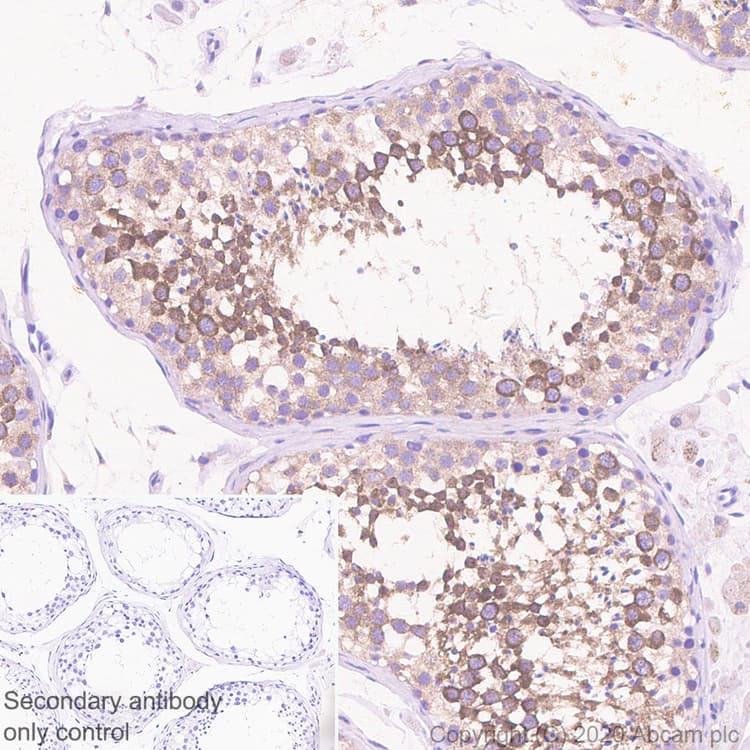 Aven Antibody Epr4720 Ab133285  Immunohistochemistry Formalin Pfa Fixed Paraffin Embedded Sections Img174035