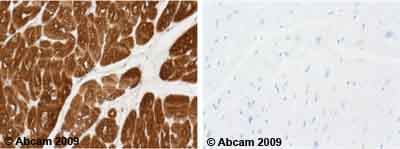 Anti-Cardiac Troponin T antibody [1C11](AB8295)