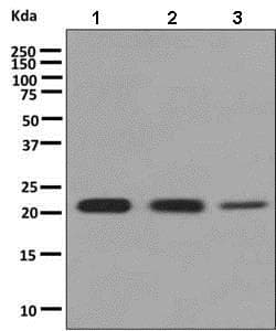 Rab22a Antibody Epr9487 Ab138505  Western Blot Img105978
