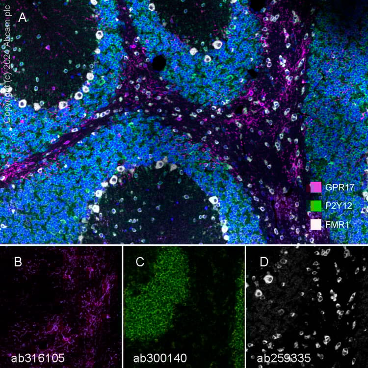 Anti-FMRP antibody [EPR23852-90] - BSA and Azide free(AB277489)