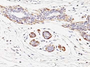 Smooth Muscle Myosin Heavy Chain I Antibody Myh11 923 Ab233940  Immunohistochemistry Formalin Pfa Fixed Paraffin Embedded Sections Img86747