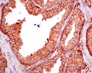 Cap1 Antibody Epr8339b Ab155079  Immunohistochemistry Formalin Pfa Fixed Paraffin Embedded Sections Img107059