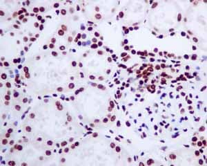 Anti-Histone H2A.Z antibody [EPR6171(2)(B)] - ChIP Grade(AB150402)