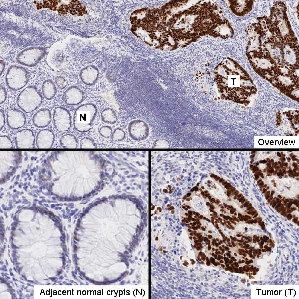 Anti-p53 antibody [DO-1] - ChIP Grade(AB1101)