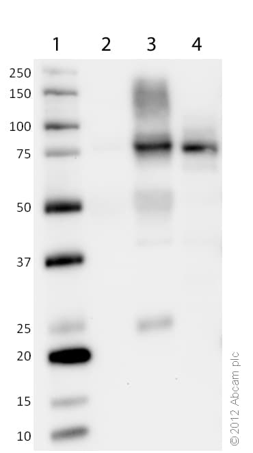 Anti-CPT1A antibody [8F6AE9](AB128568)