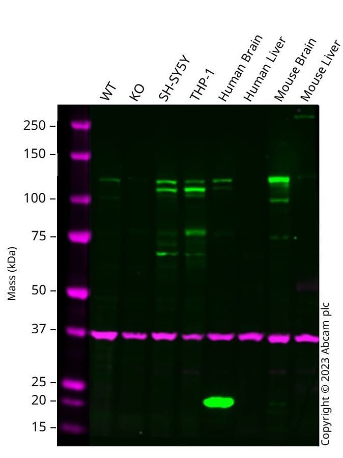 Anti-NMDAR1 antibody [EPR2481(2)](AB109182)