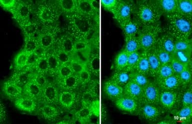 Human Papilloma Virus Type 16 E7 Antibody Hl1647 Ab308180  Immunocytochemistry Immunofluorescence Img407182