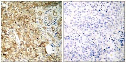 Anti-IGF1 Receptor antibody(AB131476)