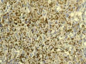 Gc1q R Antibody Epr8870 Ab134926  Immunohistochemistry Formalin Pfa Fixed Paraffin Embedded Sections Img64133