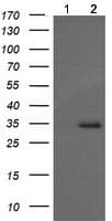 Magea4 Antibody Oti1f9 Ab139297  Western Blot Img153656