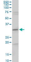 Cenph Antibody Ab88593  Western Blot Img154957