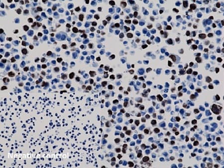6x His Tag Antibody Rm146 Ab200537  Immunocytochemistry Img64128