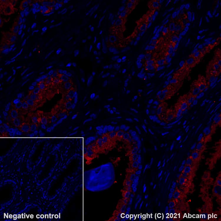 Alexa Fluor 555 Lamp2a Antibody Epr42072 Lysosome Marker Ab282009  Immunohistochemistry Formalin Pfa Fixed Paraffin Embedded Sections Img171854