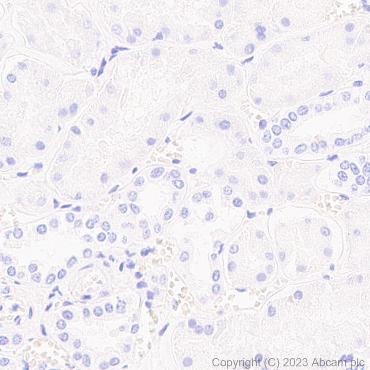 Anti-Alpha-synuclein antibody [MJFR1] - Mouse IgG2a (Chimeric)(AB309157)