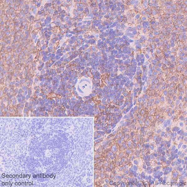 Vpac2 Antibody Sp235 Bsa And Azide Free Ab246352  Immunohistochemistry Formalin Pfa Fixed Paraffin Embedded Sections Img112948