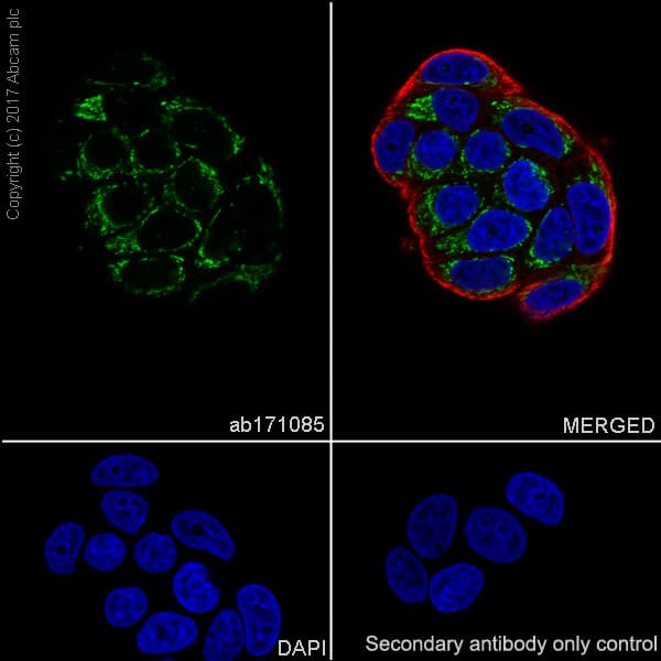 Anti-IGFBP7 antibody [EPR11912(B)](AB171085)