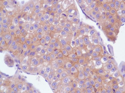 Egfr Antibody Sp84 Bsa And Azide Free Ab238803  Immunohistochemistry Formalin Pfa Fixed Paraffin Embedded Sections Img109945
