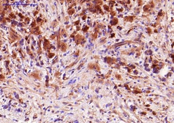 Anti-TNF alpha antibody [P/T2](AB9579)