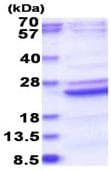 Recombinant Human B9D2 protein(AB183172)