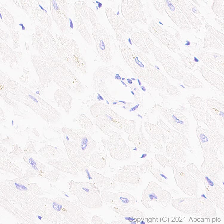 Anti-STAT4 antibody [EPR25128-48](AB284408)