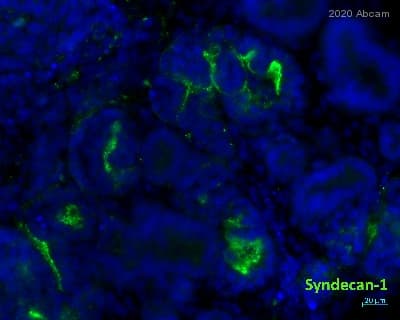 Anti-Syndecan-1 antibody [EPR6454](AB128936)