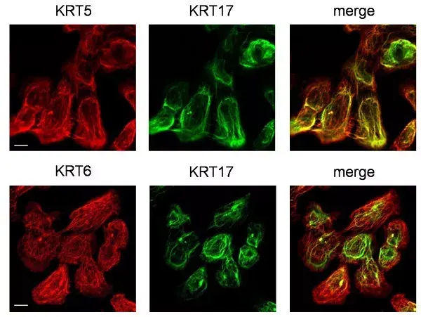 Anti-Cytokeratin 5 antibody [EP1601Y] - Cytoskeleton Marker(AB52635)