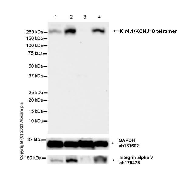 Anti-Kir4.1/KCNJ10 antibody [EPR27251-74](AB312844)