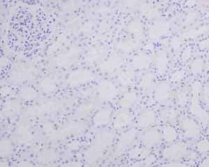 Anti-Myelin Basic Protein antibody [EPR6652](AB133620)