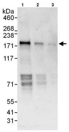 Anti-WHSC1/NSD2 antibody(AB225625)