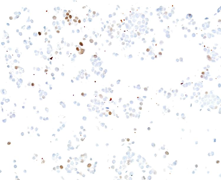Anti-ASCL1/MASH1 antibody [BLR164J] - BSA free(AB314100)