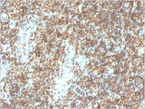 Anti-ds DNA antibody [DSD958] - BSA and Azide free(AB215906)