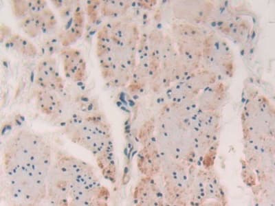 Anti-Myosin light chain kinase/MLCK antibody(AB232949)