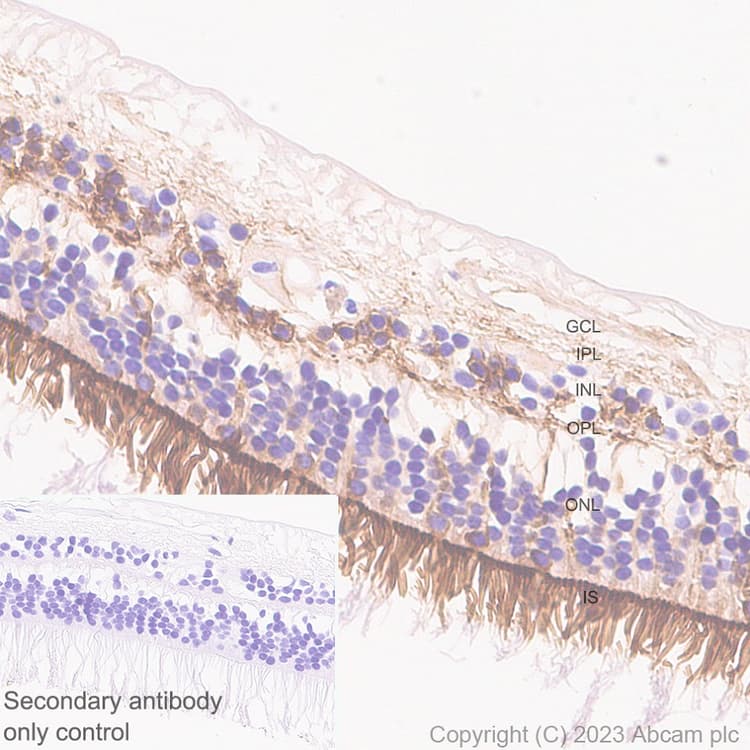 Anti-RS1 antibody [EPR28513-78](AB314231)