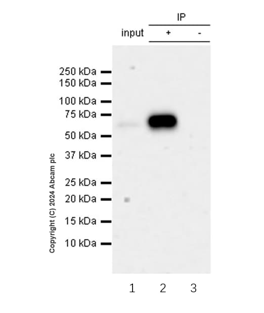 Rbpjk Antibody Rm2045 Ab317048  Immunoprecipitation Img432230