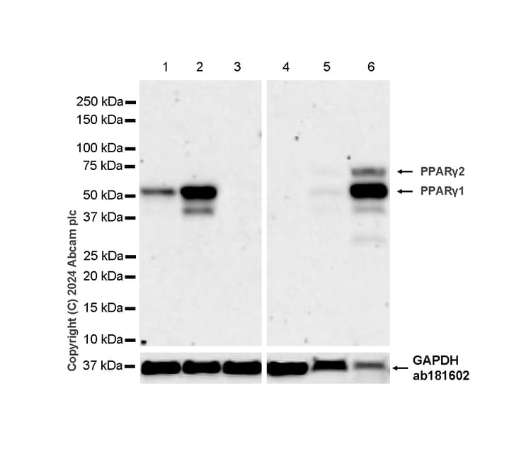 Anti-PPAR gamma antibody [RM1091](AB316981)