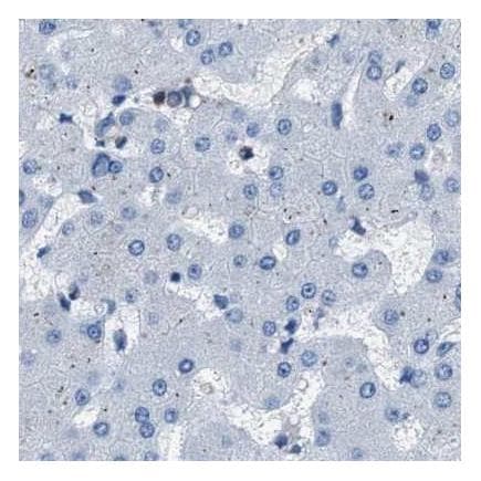 Anti-GST3 / GST pi antibody(AB259373)