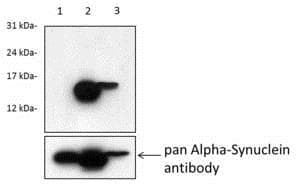 Anti-Alpha-synuclein (phospho S129) antibody [MJF-R13 (8-8)](AB168381)
