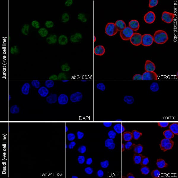 Anti-Ctip2 antibody [EPR23120-25](AB240636)