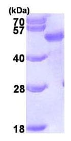 Recombinant Human SQSTM1 / p62 protein(ab95320)