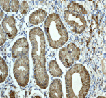 Anti-MMP9 antibody [EP1254](AB76003)