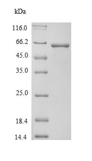 Recombinant Mouse alpha 1 Fetoprotein(ab226406)