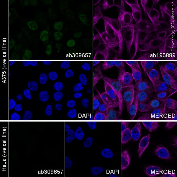 Alexa Fluor® 488 Anti-SOX10 antibody [EPR4007](AB309657)
