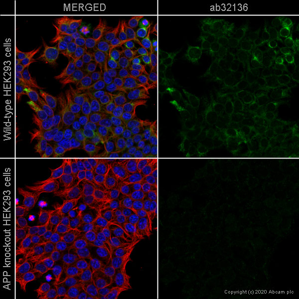 Anti-Amyloid Precursor Protein [Y188] ab32136 Recombinant | Danaher