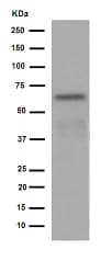 Anti-HAI-1 antibody [EPR15652](AB189511)