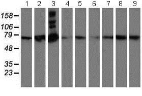 Samhd1 Antibody Oti1a1 Ab128107  Western Blot Img18147
